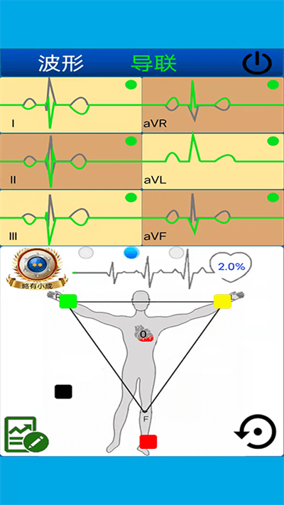 心电图计算器官方版