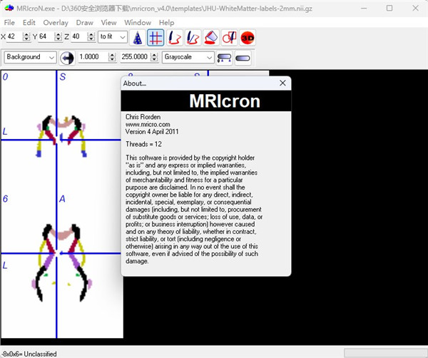 mriCroN(医学影像分析软件)